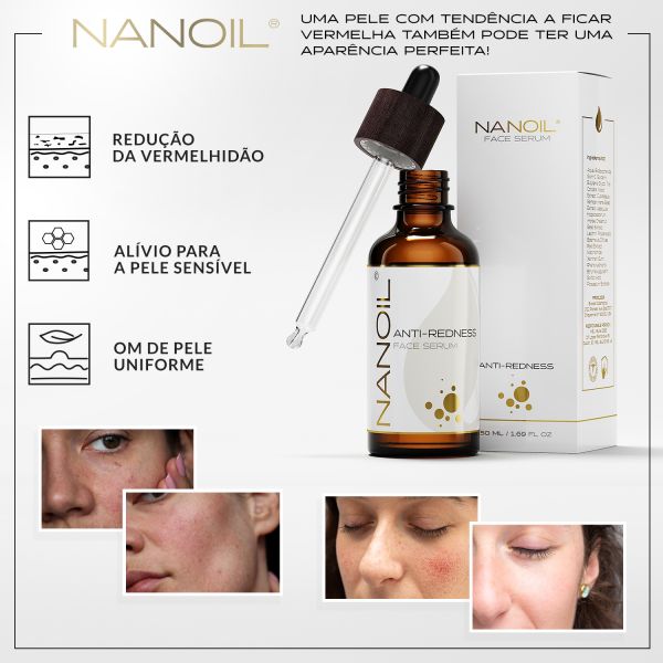 https://s1.kuantokusta.pt/img_upload/produtos_saudebeleza/605725_53_nanoil-serum-facial-anti-redness-50ml.jpg